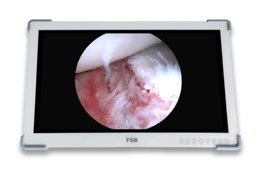 Monitor médico HD de 27" para lámpara quirúrgica