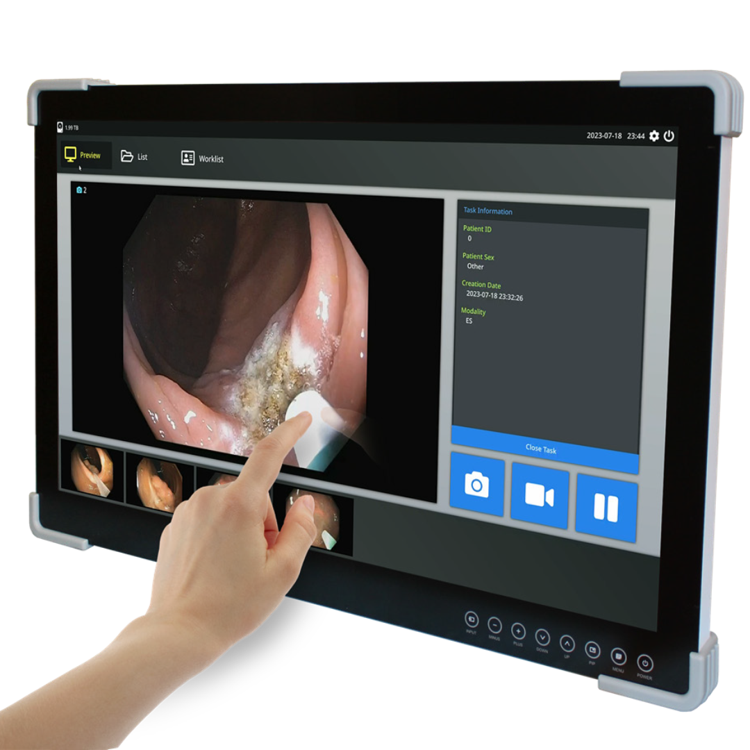 Monitor médico táctil FHD de 27" para lámpara quirúrgica Monitor médico táctil FHD de 27" para lámpara quirúrgica