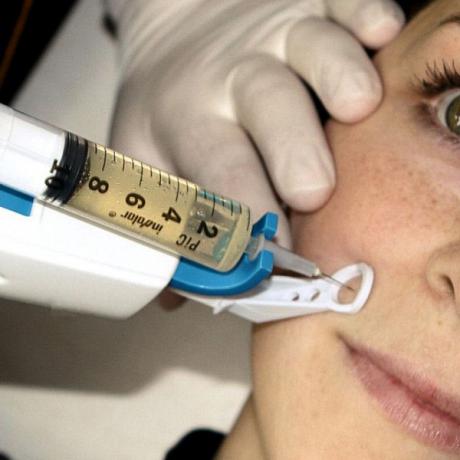 Pistola de mesoterapia y PRP, Pistor Eliance Pistola de mesoterapia y PRP, Pistor Eliance