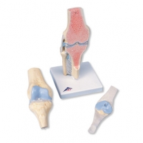 Modelo de la articulación de la rodilla, dividido en 3 partes