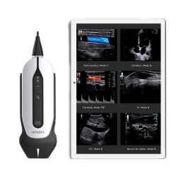 Échographe portable Chison SonoEye P1 sonde linéaire jusqu'à 14MHz + Tablette en cadeau