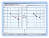 Software de audiometría Sibelmed W-50