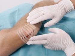 Omnistrip Tira de sutura cutánea 3 x 76 mm 50 sobres x 5 un. Color carne