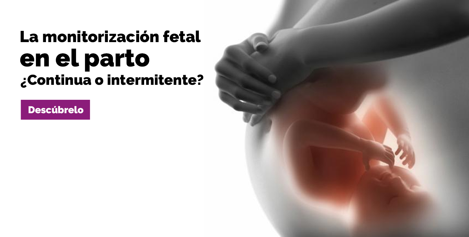 Monitorización fetal continua o intermitente: ¿Cuál se recomienda durante el parto?