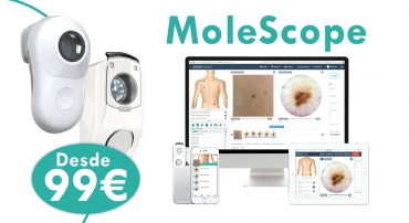 Molescope,el dermatoscopio digital profesional de bolsillo